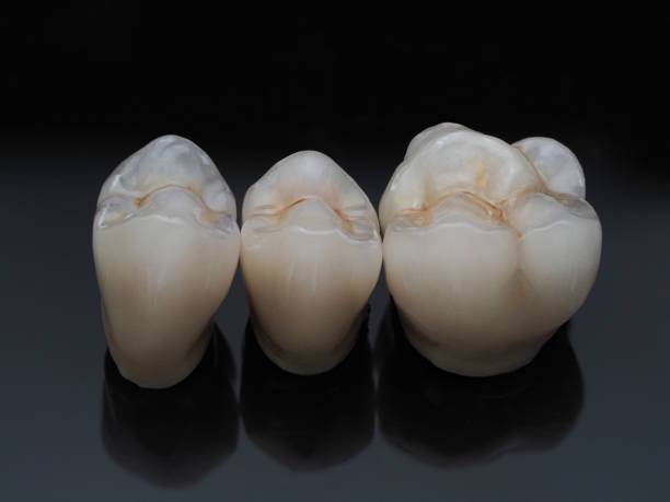 PHỤC HÌNH RĂNG SỨ DDBIO