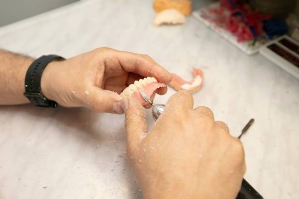 PHỤC HÌNH SỨ EMAX